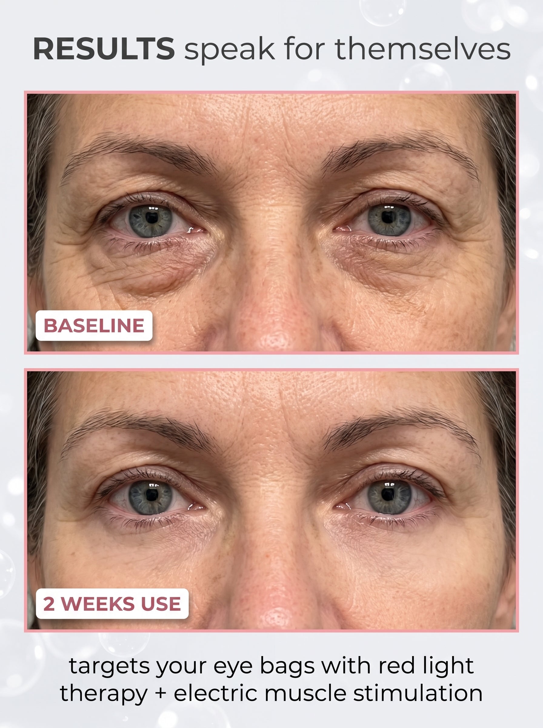 KAYA KOREAN SKIN CARE | RENEWAL EYE THERAPY