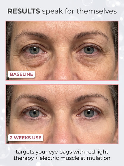 KAYA KOREAN SKIN CARE | RENEWAL EYE THERAPY